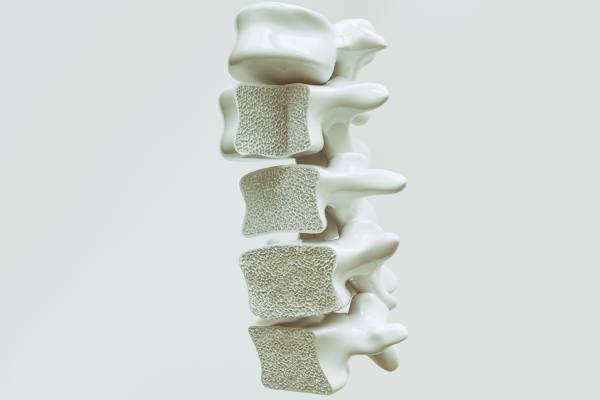 Osteoporose
